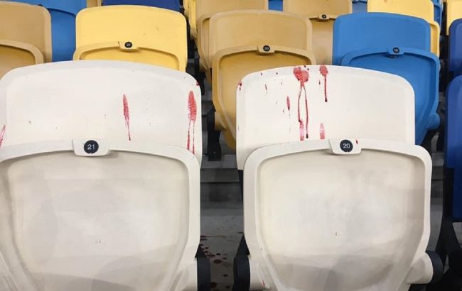"Побиті батьки і перелякані діти": у Києві під час матчу ультрас "Динамо" напали на глядачів