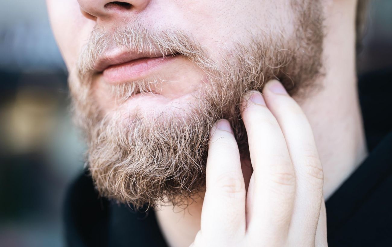 5 причин, чому не росте борода у чоловіків