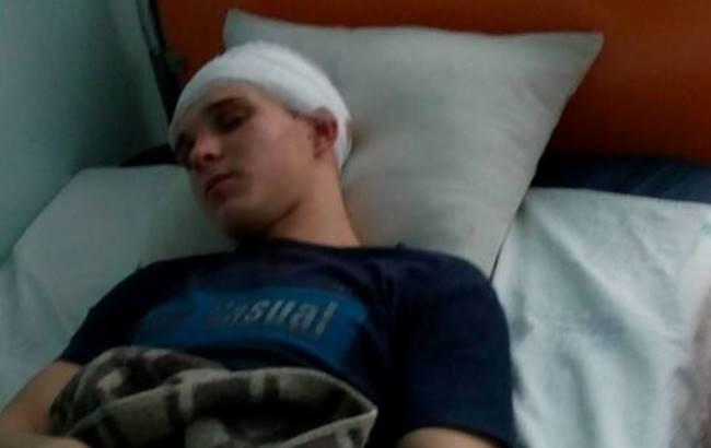 "Хотели убить": в Киевской области подростки жестоко избили парня в новогоднюю ночь