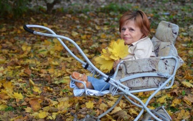 Генетичне захворювання: українців просять допомогти жінці з тілом дитини
