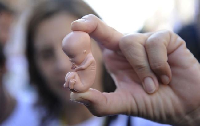 В Украине аборты могут стать незаконными