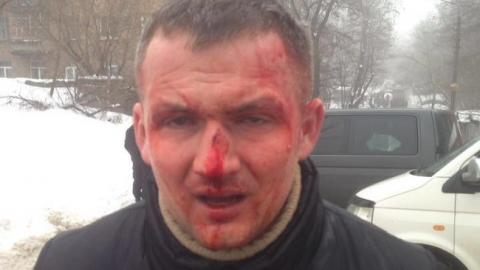 Прокуратура розслідує побиття нардепа Левченка в Києві