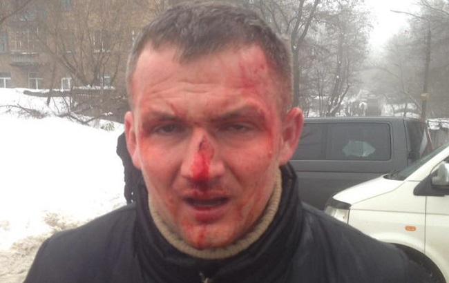 Прокуратура розслідує побиття нардепа Левченка в Києві