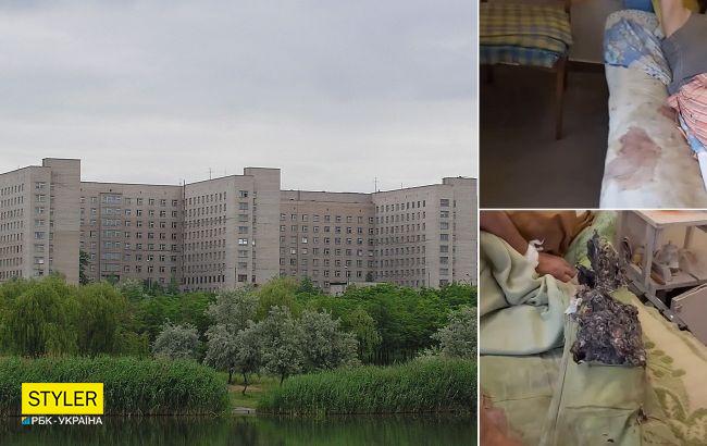 В больнице Кривого Рога пациент шокировал видео из палаты: "все вонючее, грязное, зас***ное"