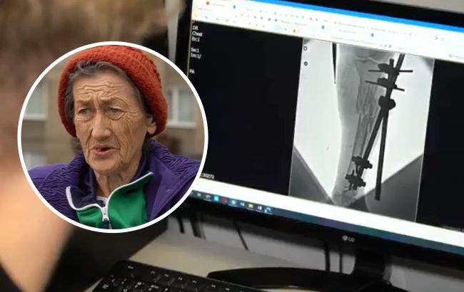 "Родным сказали, что я погибла": во Львове спасли жизнь женщине из Бахмута