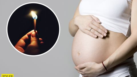 В Кривом Роге парень поджег свою беременную возлюбленную: новые детали трагедии