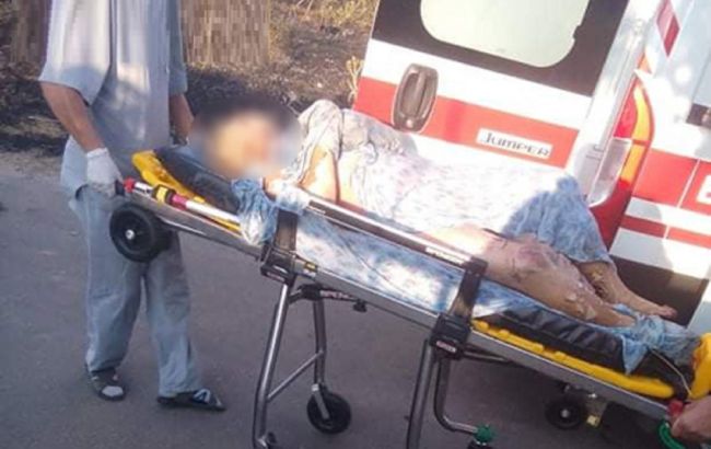 В Николаевской области пенсионерка устроила пожар в селе: ее госпитализировали с ожогами