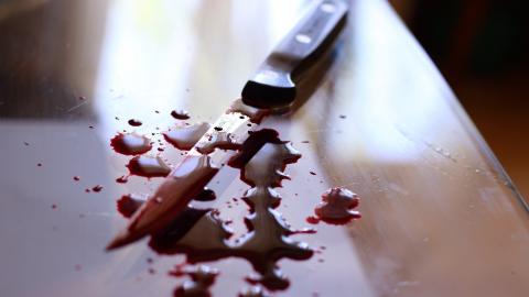 У Харківській області жінка изрезала обличчя своєї подруги