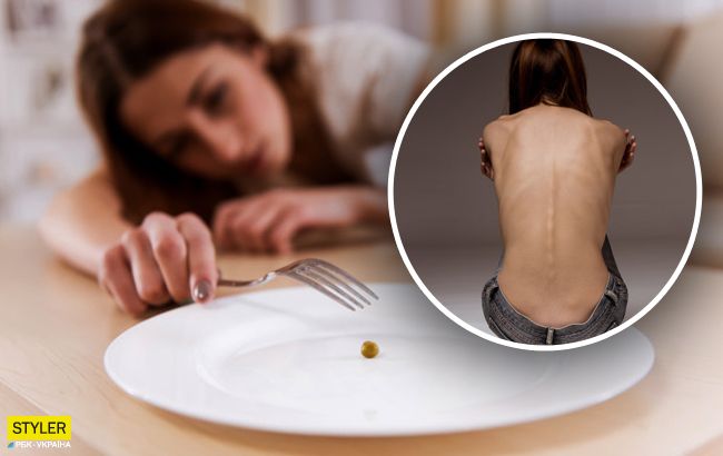 Очень хотела похудеть: студентку из Прикарпатья погубила новая диета