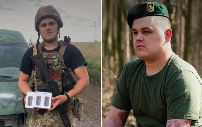 "Победить ради сына". Пограничник с 70% ожогов кожи вернулся на службу