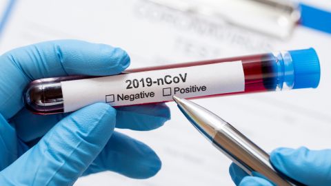 ВОЗ: более 2 миллионов случаев коронавируса приходится на Европу