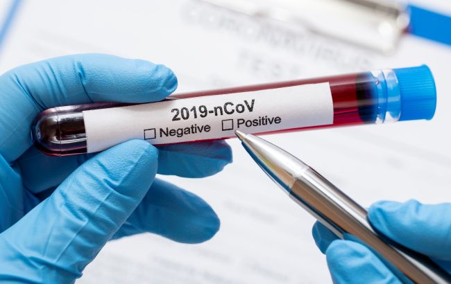 Понад 60 країн закликали розслідувати походження коронавірусу