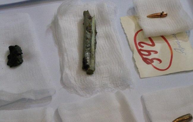 В Днепре врачи собрали "коллекцию" осколков, извлеченных из бойцов АТО