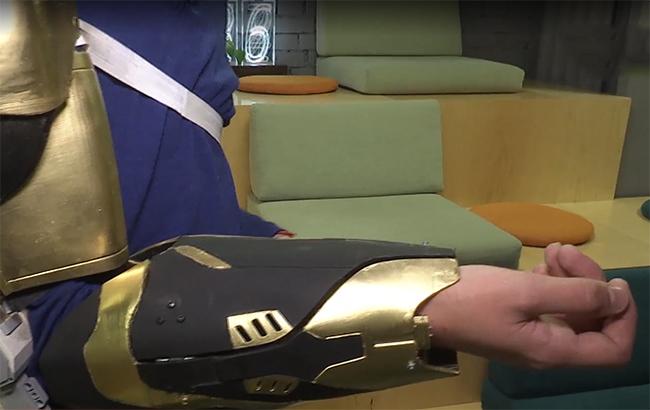 Украинец создал искусственный скелет, помогающий реабилитироваться после травм