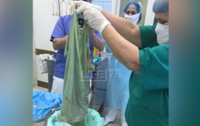 В России врачи забыли простынь внутри пациентки