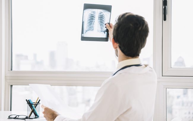 Є інша причина: лікарі з'ясували походження раку легенів у тих, хто не курить