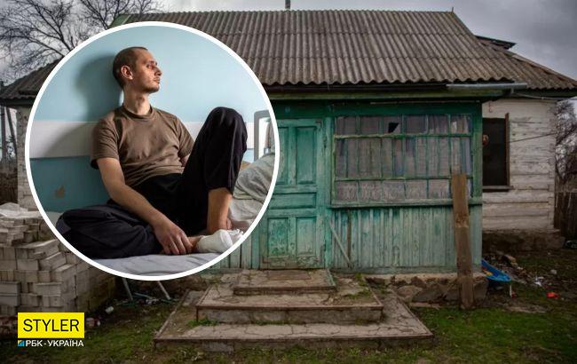 Месяц в подвалах, еще столько же в плену у РФ: украинец вернулся домой без пальцев