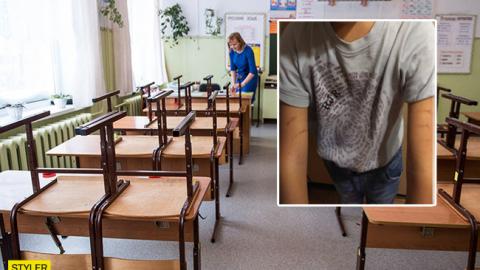 Вчитель тягнув за руки: школяр прийшов додому зі слідами побоїв