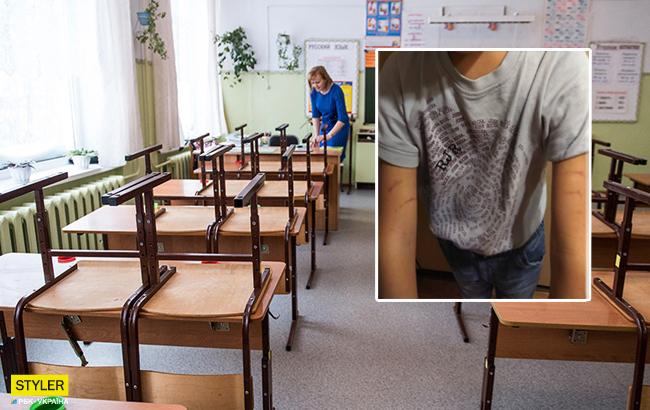 Учитель тянул за руки: школьник пришел домой со следами побоев