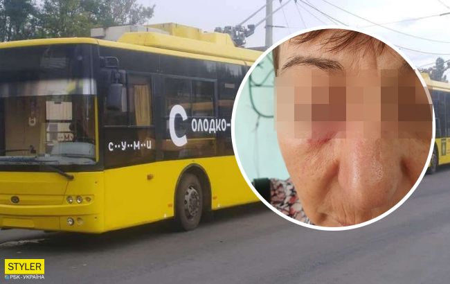У Сумах пасажирка понівечила кондуктора через маску: фото і деталі НП