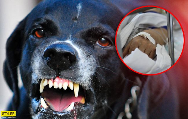 Спасти не удалось: под Харьковом домашний пес набросился на свою хозяйку