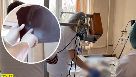 Под Винницей трехлетний малыш перестал ходить и говорить после COVID-19