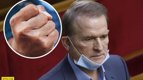 "Он никогда не просил прощения": журналисты нашли мужчину, которого избил Медведчук