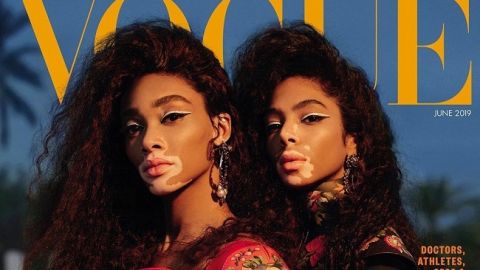 Красота в глазах смотрящего: Винни Харлоу и модель с витилиго блистают на обложке известного глянца