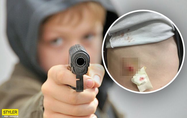 Принес пистолет и начал угрожать: в Николаеве школьник подстрелил одноклассника