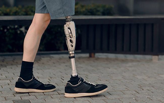 У Дніпропетровській області безкоштовно протезують кінцівки