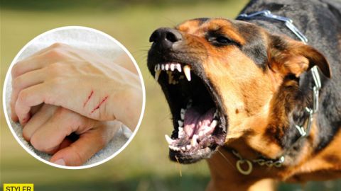 Наукового підтвердження немає: Комаровський відповів на важливе питання про сказ