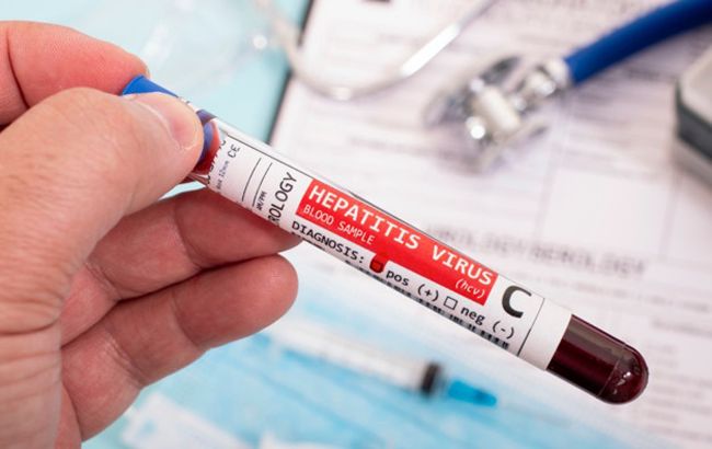 Гепатит С вбиває повільно і непомітно: хто перебуває в групі ризику