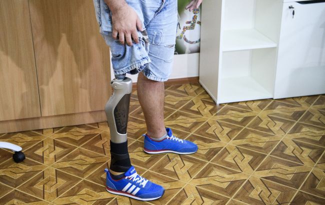 В Минсоцполитики напомнили, как украинцам бесплатно получить протез