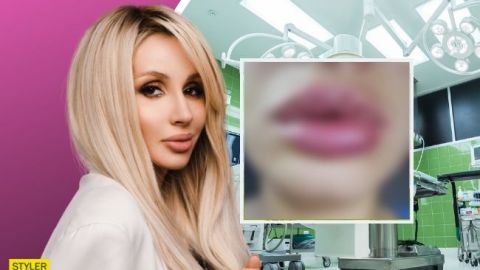 Переборщила: Лободу уличили в новой пластической операции