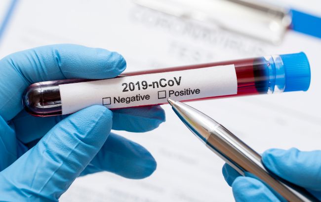 Винайдений "миттєвий" тест на коронавірус: коли з'явиться в продажу