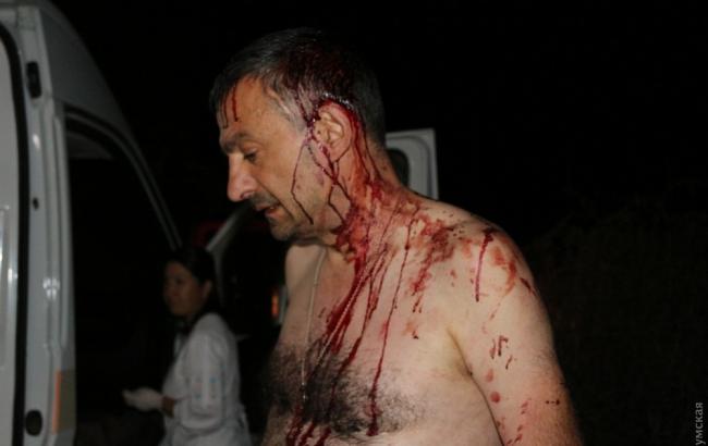 Под Одессой жестоко избили украинского журналиста