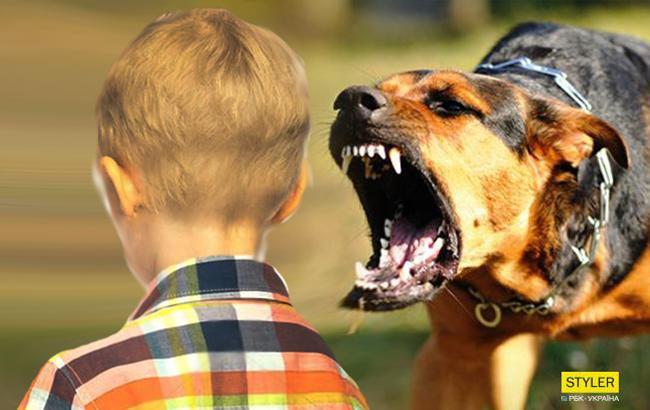 У Миколаєві собака вчепився в обличчя чотирирічній дитині