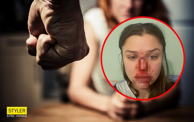 "Ищу возможность выйти из этого ада": киевский психолог заявила о домашнем насилии в свой адрес