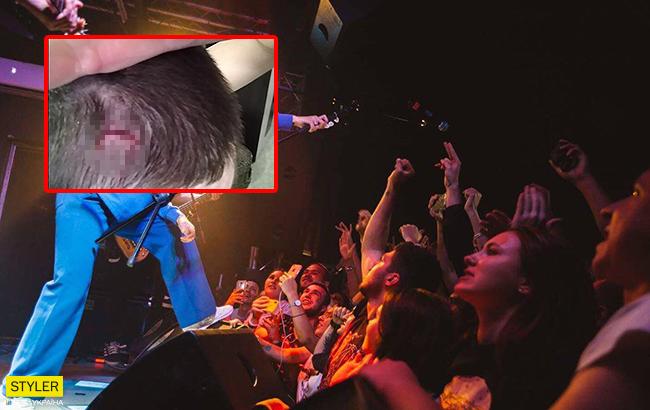 Кровавый концерт: российский музыкант разбил голову фанату во время выступления