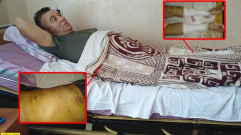 Координатор C14 розповів про стан батька після замаху