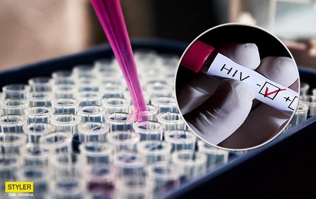 Чому варто пройти тест на ВІЛ: опублікована загрозлива статистика