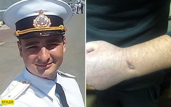 "Пальці не згинаються": адвокат розповів про здоров'я військовополоненого моряка