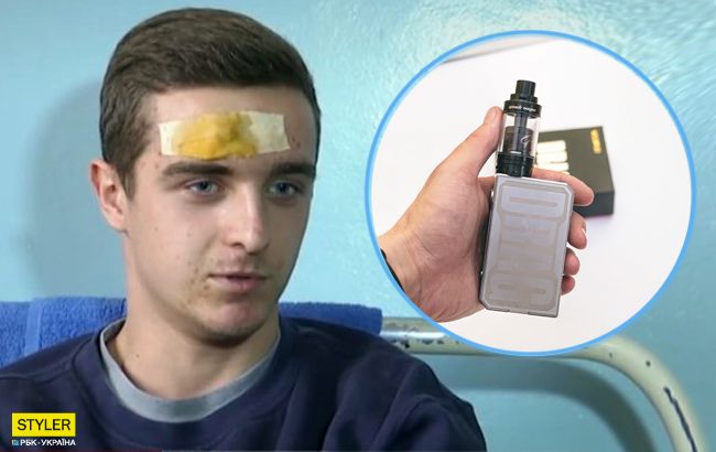 Чудом остался жив: в Павлограде в руках у подростка взорвалась электронная сигарета