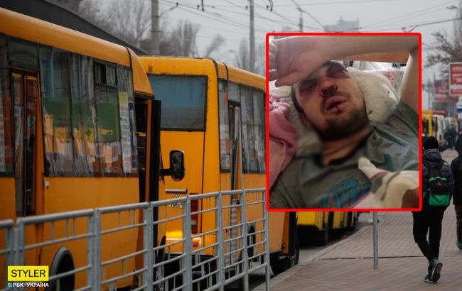 Под Киевом маршрутчик зверски избил пассажира: лечение загнало в долги