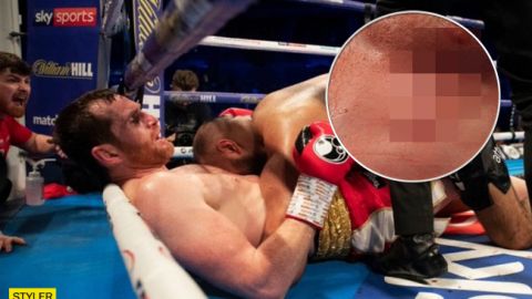 Прийом Тайсона: боксер покусав суперника на ринзі (фото, відео)