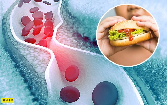 У Супрун рассказали, где и как украинцам бесплатно проверить уровень холестерина