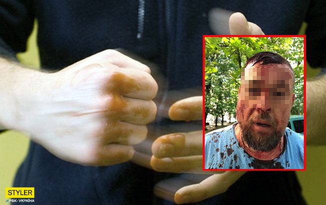 Добивали кастетом: в Харькове напали на известного активиста (видео 18+)