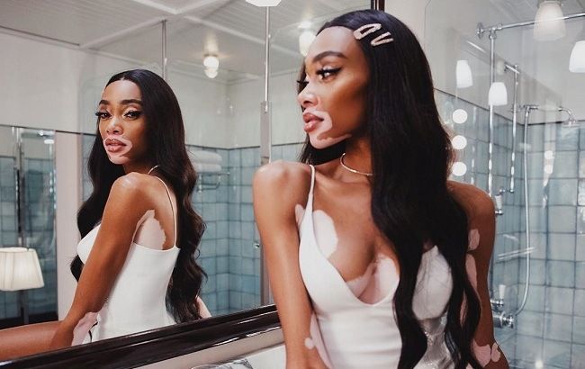 Легкость бытия: Винни Харлоу восхитила невесомым летним образом и стройными ногами