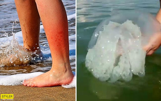 Узбережжя Азовського моря атакували величезні жалючі медузи (відео)