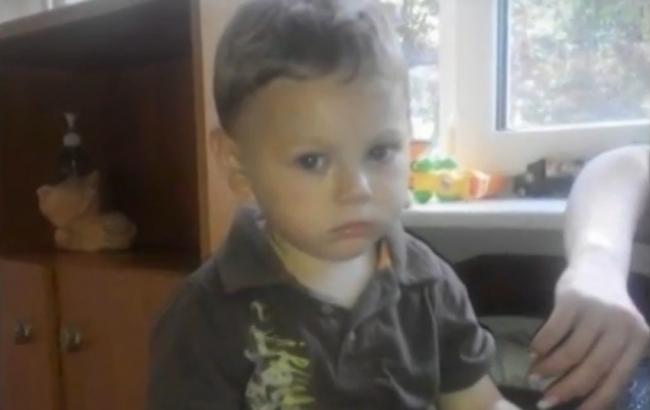 В Одессе обнаружился еще один избитый ребенок
